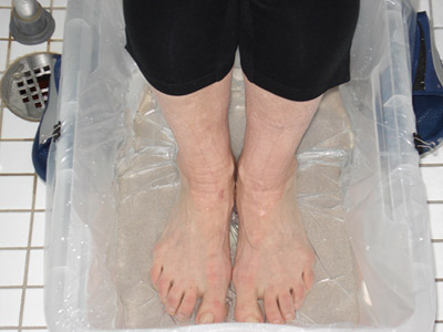 Ionic Detoxification Foot Bath | Fungus Doctor | Toronto, Ontario, Canada